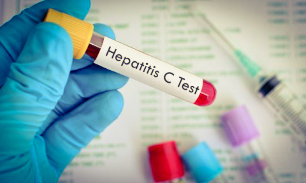De luna aceasta începe campania de testare pentru depistarea hepatitelor virale B/D și C în județul Vâlcea